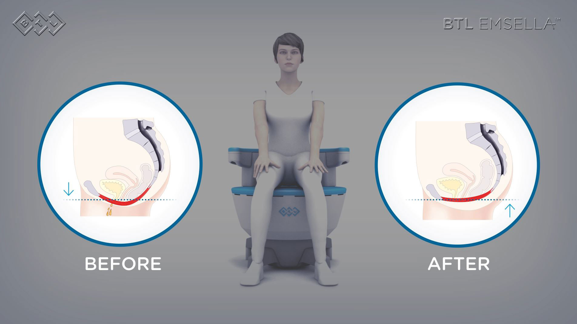 What Is Introspective Breathwork Therapy