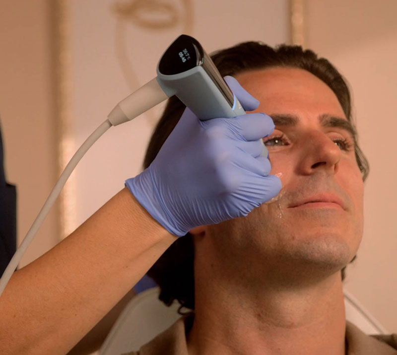 Exion Skin Regeneration